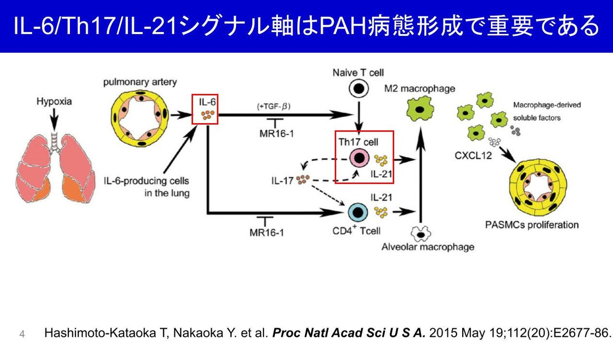 第7回日本肺高血圧・肺循環学会レポート】膠原病性肺動脈性肺 | Medical Note Expert (メディカルノート エキスパート) 3792円