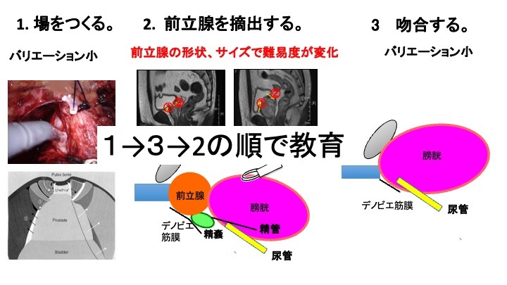 第59回日本癌治療学会レポート】泌尿器科ロボット支援手術の | Medical