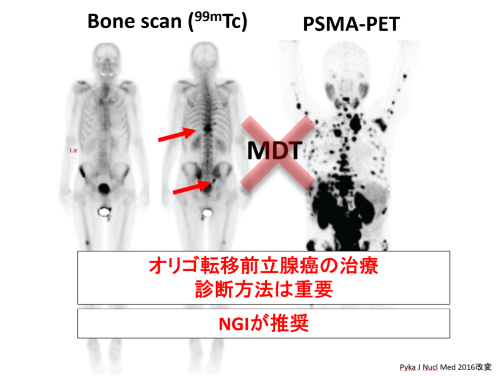 治療中の食事と生活習慣